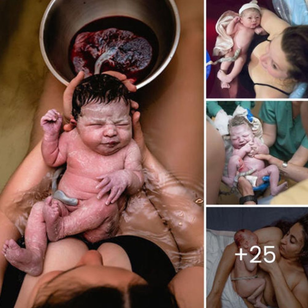 The authentic photo series capturing the profound umbilical cord connection between a baby and its mother has deeply touched the hearts of many viewers.D